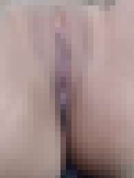 昨天除毛，看着如何？_昨天除毛，看着如何？_4